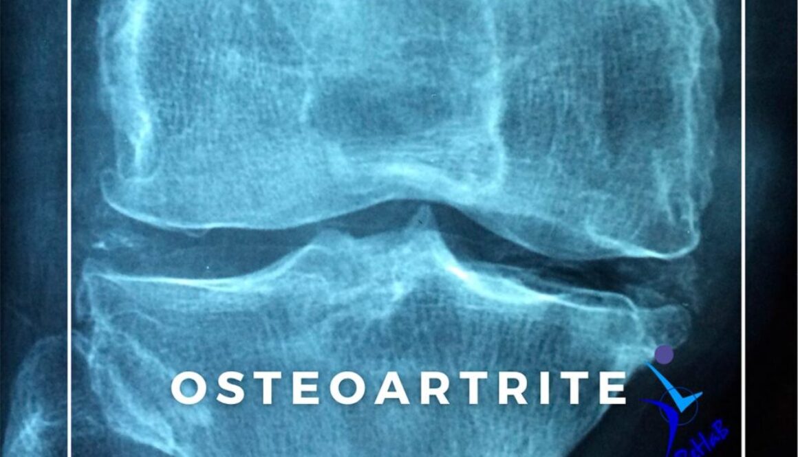 post-osteoatrite